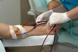 Vascular Access for Hemodialysis treatment in hyderabad