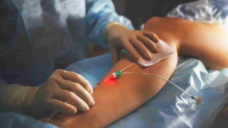 Angiocare Varicose Veins Treatment in Kukatpally Hyderabad